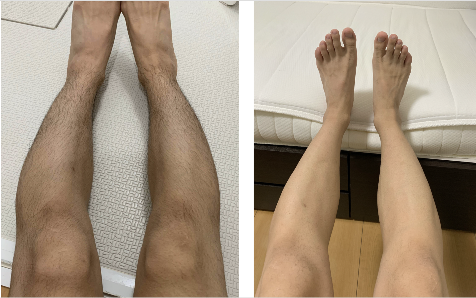 【脱毛】Zリムーバーで感じた効果をランキング形式で発表し ...